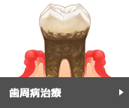 歯周病