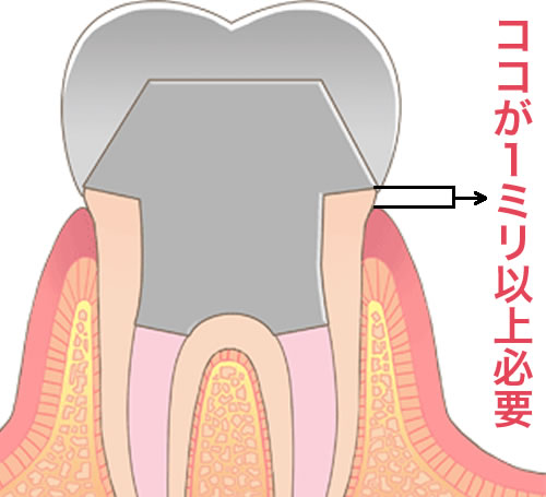 フェルール効果